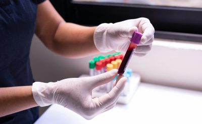 vitamin d blood test awareness